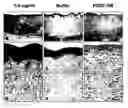 Fig. 01 - Methods for treating diabetic wounds
