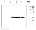 Fig. 01 - Alpha-1-Antitrypsin Variants and Uses Thereof