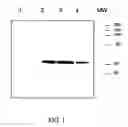 Fig. 02 - Alpha-1-Antitrypsin Variants and Uses Thereof