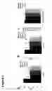 Fig. 08 - METHODS OF TREATING AND PREVENTING NEOVASCULARIZATION WITH OMEGA-3 POLYUNSATURATED FATTY ACIDS