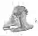 Fig. 02 - Multipath Stimulation Hearing Systems