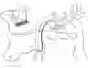 Fig. 01 - System and method for accurate placement of a catheter tip in a patient