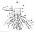 Fig. 05 - Method and system for detecting electrophysiological changes in pre-cancerous and cancerous breast tissue and epithelium