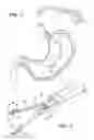 Fig. 02 - Endosurgery suturing device