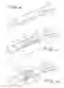 Fig. 06 - Vein filter