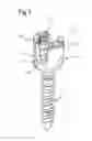 Fig. 02 - Bone anchoring device