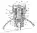 Fig. 01 - Pressure relief valve