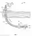 Fig. 02 - Drill bit with weight and torque sensors and method of making a drill bit