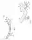 Fig. 22 - CART ASSEMBLIES FOR USE WITH BLOOD FILTRATION