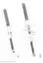Fig. 03 - Toothed rack or threaded rod