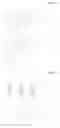 Fig. 02 - Radio frequency filter