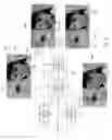 Fig. 05 - SYSTEMS AND METHODS FOR PICTURE ENHANCEMENT