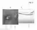 Fig. 03 - Method and apparatus for retinal diagnosis