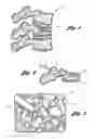Fig. 02 - Vertebroplasty all in one mixer