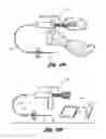 Fig. 12 - Vertebroplasty all in one mixer