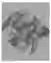 Fig. 01 - PARALLEL BEAM LOCAL TOMOGRAPHY RECONSTRUCTION METHOD