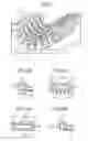 Fig. 03 - Radiological imaging apparatus