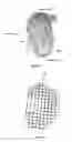 Fig. 04 - Fusion of multiple imaging planes for isotropic imaging in MRI and quantitative image analysis using isotropic or near-isotropic imaging