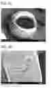 Fig. 09 - CALCIUM PHOSPHATE BODIES AND A PROCESS FOR MAKING CALCIUM PHOSPHATE BODIES
