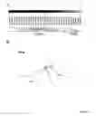 Fig. 02 - Methods for diagnosis of common acute lymphoblastic leukemia by determining the level of gene expression