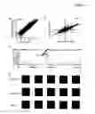 Fig. 02 - SLIT2 underexpression in metastatic prostate cancer
