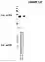 Fig. 167 - IMMUNIZATION AGAINST CHLAMYDIA PNEUMONIAE