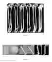 Fig. 07 - METHODS AND COMPOSITIONS FOR THE TREATMENT AND PREVENTION OF BONE LOSS