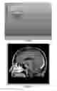 Fig. 02 - System and method for pre-planning a radiation treatment
