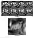 Fig. 09 - System and method for pre-planning a radiation treatment