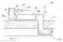 Fig. 01 - IMPLANTABLE OCULAR PUMP TO REDUCE INTRAOCULAR PRESSURE