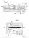 Fig. 08 - Drainage system for treating hydrocephalus