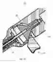 Fig. 57 - Injection systems