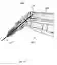 Fig. 81 - Injection systems