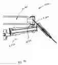 Fig. 93 - Injection systems