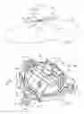 Fig. 02 - Organ access device and method