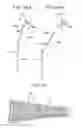 Fig. 09 - Medical guide wire
