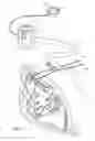 Fig. 07 - Surgical securement system and apparatus