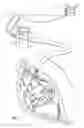 Fig. 08 - Surgical securement system and apparatus