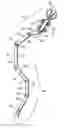 Fig. 01 - Laparoscopic instrument and related surgical method
