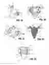 Fig. 07 - Laparoscopic instrument and related surgical method