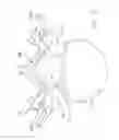 Fig. 06 - Multiple facet joint replacement