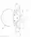 Fig. 09 - Multiple facet joint replacement