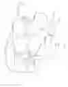 Fig. 16 - Multiple facet joint replacement