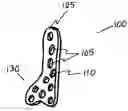 Fig. 01 - Tibia-talus-calcaneus (T-T-C) locking plate