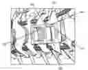 Fig. 01 - IMPLANTABLE BONE PLATE SYSTEM AND RELATED METHOD FOR SPINAL REPAIR