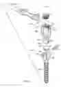 Fig. 07 - Bone anchor for receiving a rod for stabilization and motion preservation spinal implantation system and method