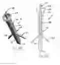 Fig. 09 - MULTI-ANCHOR ANTI-BACK OUT MECHANISM AND METHOD