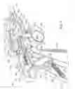 Fig. 08 - Disc repair system