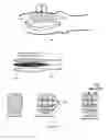 Fig. 06 - Device, system, and method to improve powered muscle stimulation performance in the presence of tissue edema