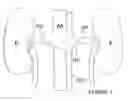 Fig. 02 - Methods and apparatus for pulsed electric field neuromodulation via an intra-to-extravascular approach